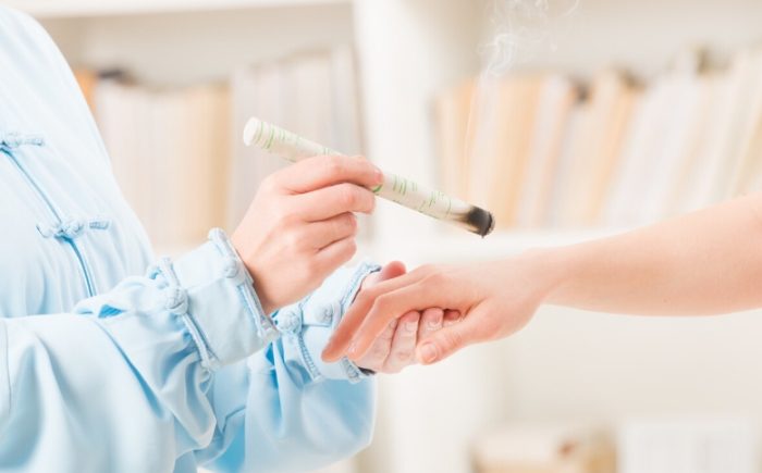 艾灸療法 艾灸療法